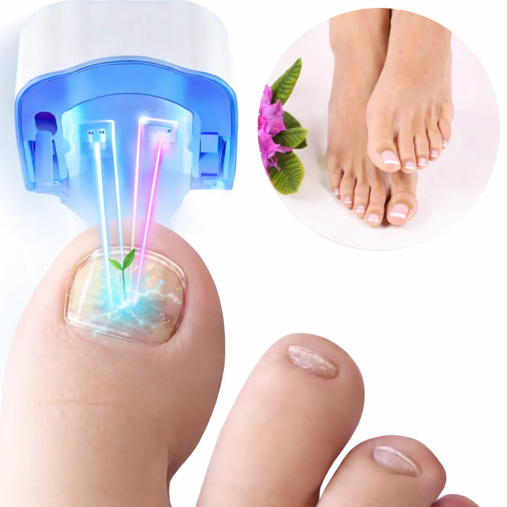 NailPro™ | Elimina Hongos en Uñas con Láser – Rápido, Seguro y Sin Dolor